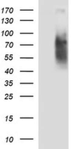 CD44 Monoclonal Antibody (OTI1C8), TrueMAB , OriGene 100 &mu;L; Unconjugated:Antibodies,