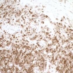CD45 Recombinant Rabbit Monoclonal Antibody (BL-178-12C7), Bethyl Laboratories
