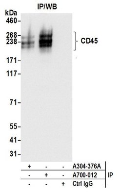 CD45 Recombinant Rabbit Monoclonal Antibody (BL-178-12C7), Bethyl Laboratories:Antibodies:Primary