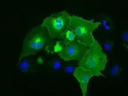 CD5 Monoclonal Antibody (OTI2B8), TrueMAB , OriGene 100 &mu;L; Unconjugated:Antibodies,