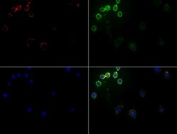 CD5 Mouse anti-Human, Clone: UMAB9, lyophilized, UltraMAB 100 &mu;g; Unconjugated:Antibodies,