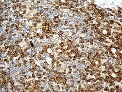 CD5 Monoclonal Antibody (OTI6F7), TrueMAB , OriGene 30 &mu;L; Unconjugated:Antibodies,