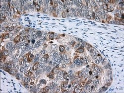 CD5 Monoclonal Antibody (OTI7A7), TrueMAB , OriGene 100 &mu;L; Unconjugated:Antibodies,