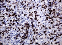 CD5 Mouse anti-Human, Clone: UMAB9, lyophilized, UltraMAB 100 &mu;g; Unconjugated:Antibodies,