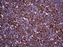 CD5 Mouse anti-Human, Clone: UMAB9, lyophilized, UltraMAB 100 &mu;g; Unconjugated:Antibodies,