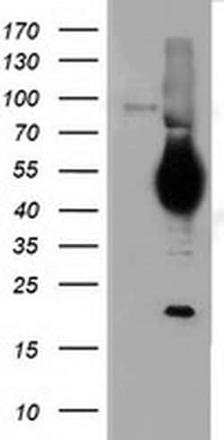 CD5 Monoclonal Antibody (OTI6F7), TrueMAB , OriGene 30 &mu;L; Unconjugated:Antibodies,