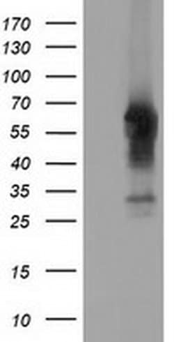 CD5 Monoclonal Antibody (OTI2B8), TrueMAB , OriGene 100 &mu;L; Unconjugated:Antibodies,
