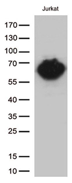 CD5 Monoclonal Antibody (OTI2B8), TrueMAB , OriGene 100 &mu;L; Unconjugated:Antibodies,