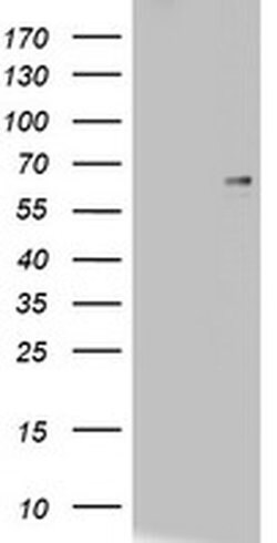 CD5 Monoclonal Antibody (OTI8C10), TrueMAB , OriGene 100 &mu;L; Unconjugated:Antibodies,