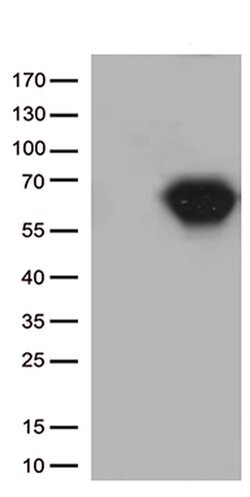 CD5 Monoclonal Antibody (OTI2C2), TrueMAB , OriGene 30 &mu;L | Buy Online | Origene Technologies | Fisher Scientific