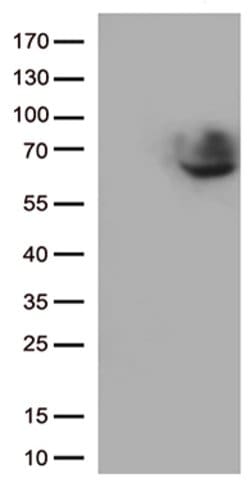 CD5 Mouse anti-Human, Clone: OTI2D8, lyophilized, TrueMAB 100 &mu;g; Unconjugated:Antibodies,