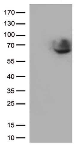 CD5 Monoclonal Antibody (OTI2D8), TrueMAB , OriGene 100 &mu;L; Unconjugated:Antibodies,