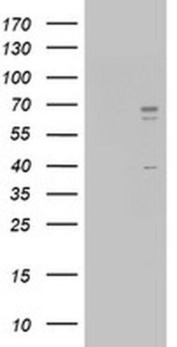 CD5 Monoclonal Antibody (OTI4F9), TrueMAB , OriGene 100 &mu;L; Unconjugated:Antibodies,