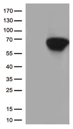 CD5 Monoclonal Antibody (OTI9E9), TrueMAB , OriGene 100 μL; Unconjugated:Antibodies,