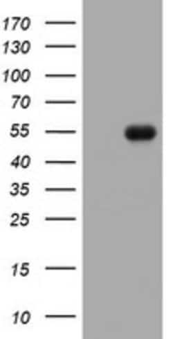 CD5 Mouse anti-Human, Clone: OTI5D4, lyophilized, TrueMAB 100 &mu;g | Buy Online | OriGene | Fisher Scientific
