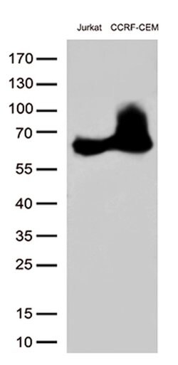 CD5 Mouse anti-Human, Clone: UMAB9, lyophilized, UltraMAB 100 &mu;g; Unconjugated:Antibodies,