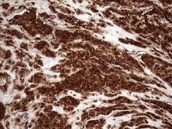 CD63 Monoclonal Antibody (OTI1E10), TrueMAB , OriGene 100 &mu;L; Unconjugated:Antibodies,