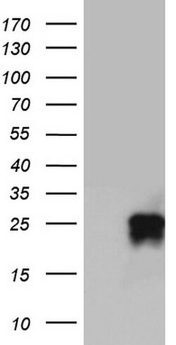 CD63 Monoclonal Antibody (OTI1E7), TrueMAB , OriGene:Antibodies:Primary