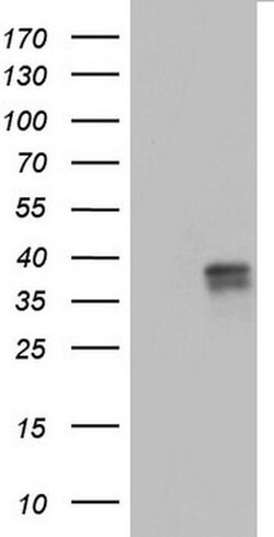 CD63 Monoclonal Antibody (OTI1E10), TrueMAB , OriGene 100 &mu;L; Unconjugated:Antibodies,