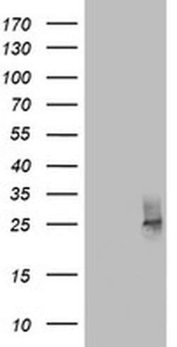 CD63 Monoclonal Antibody (OTI2D5), TrueMAB , OriGene 100 &mu;L; Unconjugated:Antibodies,