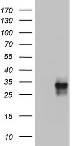 CD63 Monoclonal Antibody (OTI3D9), TrueMAB , OriGene 100 &mu;L; Unconjugated:Antibodies,