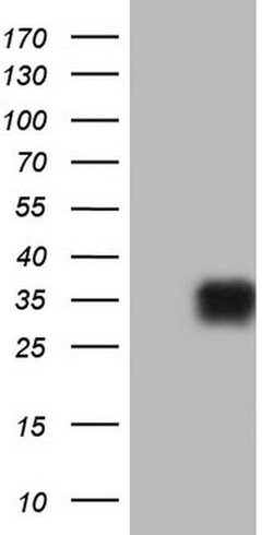 CD63 Monoclonal Antibody (OTI7F1), TrueMAB , OriGene 100 &mu;L; Unconjugated:Antibodies,