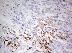 CD68 Mouse anti-Human, Clone: OTI8A4, lyophilized, TrueMAB 100 &mu;g; Unconjugated:Antibodies,