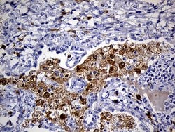 CD68 Monoclonal Antibody (OTI2E2), TrueMAB , OriGene 100 &mu;L; Unconjugated:Antibodies,
