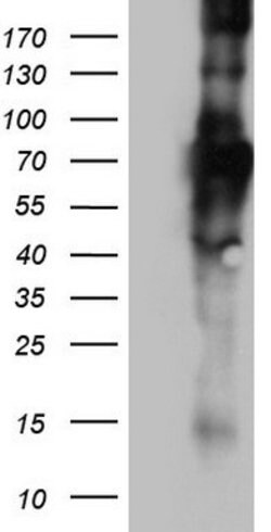 CD68 Mouse anti-Human, Clone: OTI4E3, lyophilized, TrueMAB 100 &mu;g; Unconjugated:Antibodies,