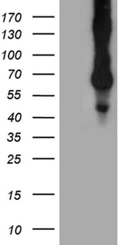 CD68 Monoclonal Antibody (OTI2E2), TrueMAB , OriGene 100 &mu;L; Unconjugated:Antibodies,