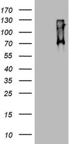 CD68 Mouse anti-Human, Clone: OTI12A3, lyophilized, TrueMAB 100 &mu;g;