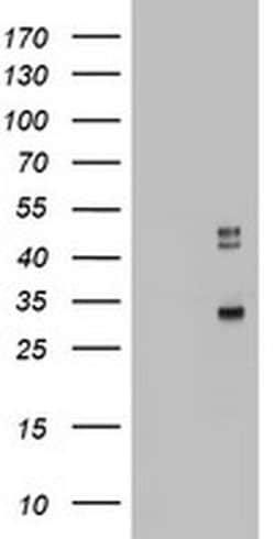 CD68 Monoclonal Antibody (OTI12D1), TrueMAB , OriGene:Antibodies:Primary