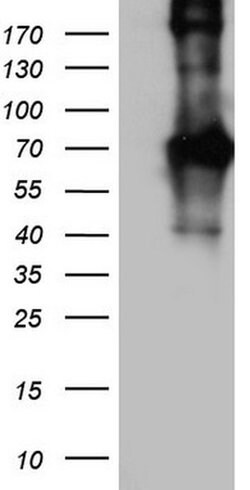 CD68 Monoclonal Antibody (OTI10E4), TrueMAB , OriGene 100 &mu;L; Unconjugated:Antibodies,