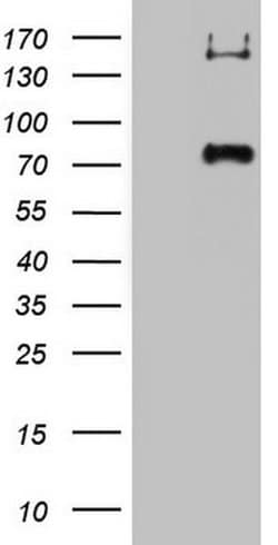 CD68 Monoclonal Antibody (OTI12C5), TrueMAB , OriGene 100 &mu;L; Unconjugated:Antibodies,