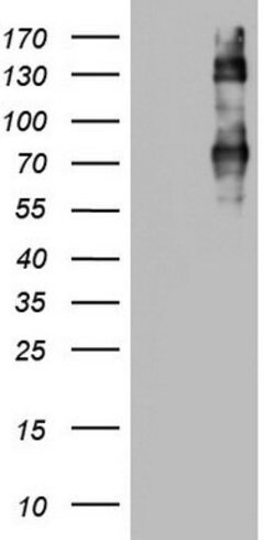 CD68 Mouse anti-Human, Clone: OTI6A10, lyophilized, TrueMAB 100 &mu;g;