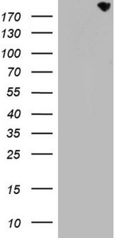 CD68 Mouse anti-Human, Clone: OTI1E6, lyophilized, TrueMAB 100 &mu;g; Unconjugated:Antibodies,