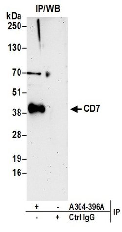 CD7 Rabbit anti-Human, Polyclonal, Bethyl Laboratories 100 &mu;L | Buy Online | Bethyl Laboratories, Inc | Fisher Scientific