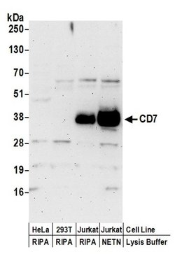 CD7 Rabbit anti-Human, Polyclonal, Bethyl Laboratories 100 &mu;L | Buy Online | Bethyl Laboratories, Inc | Fisher Scientific