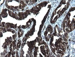 CD74 Monoclonal Antibody (OTI1H3), TrueMAB , OriGene 100 &mu;L; Unconjugated:Antibodies,
