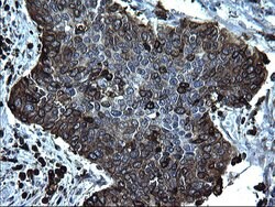CD74 Monoclonal Antibody (OTI1H3), TrueMAB , OriGene 100 &mu;L; Unconjugated:Antibodies,