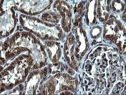 CD74 Monoclonal Antibody (OTI1H3), TrueMAB , OriGene 100 &mu;L; Unconjugated:Antibodies,