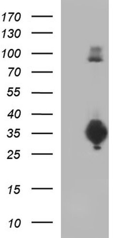 CD74 Monoclonal Antibody (OTI1H3), TrueMAB , OriGene 100 &mu;L; Unconjugated:Antibodies,