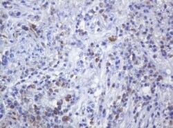 CD79A Monoclonal Antibody (OTI5E2), TrueMAB , OriGene 30 &mu;L; Unconjugated:Antibodies,