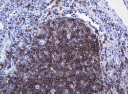 CD79A Monoclonal Antibody (OTI5E2), TrueMAB , OriGene 30 &mu;L; Unconjugated:Antibodies,