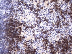 CD79A Mouse anti-Human, Clone: OTI3D3, lyophilized, TrueMAB 100 &mu;g;