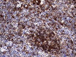 CD79A Mouse anti-Human, Clone: OTI3D3, lyophilized, TrueMAB 100 &mu;g;