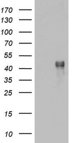 CD79A Mouse anti-Human, Clone: OTI3D3, lyophilized, TrueMAB 100 &mu;g;