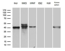 CD79A Mouse anti-Human, Clone: OTI3D3, lyophilized, TrueMAB 100 &mu;g;