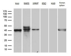 CD79A Monoclonal Antibody (OTI3D3), TrueMAB , OriGene 100 &mu;L; Unconjugated:Antibodies,