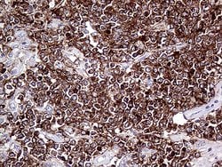 CD79B Monoclonal Antibody (OTI9H8), TrueMAB , OriGene 100 &mu;L; Unconjugated:Antibodies,